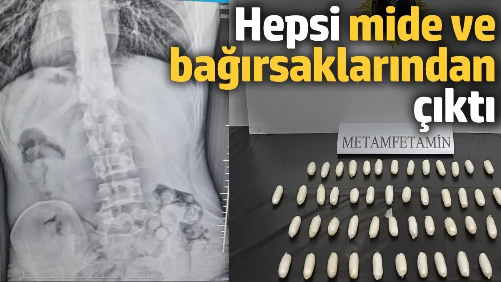 Mide ve bağırsaklarından 51 kapsül uyuşturucu çıktı