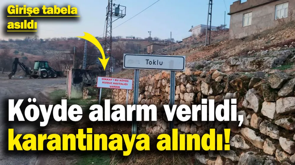 6 yaşındaki çocuğa köpek saldırmıştı! 