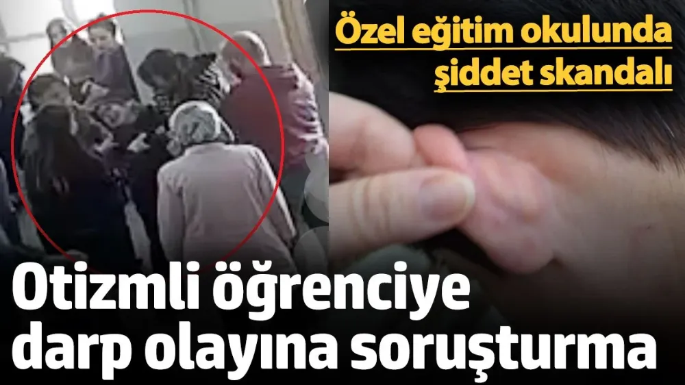Özel eğitim okulunda şiddet skandalı! 