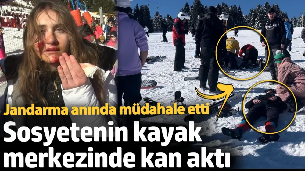 Sosyetenin kayak merkezinde kan aktı! 