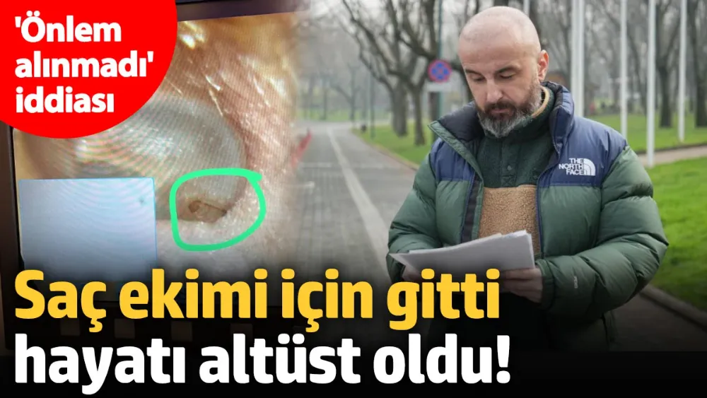 Saç ekimi için gitti, hayatı altüst oldu!