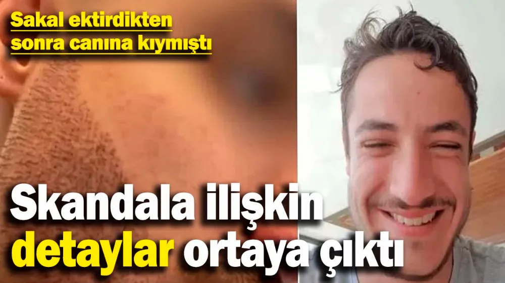 Sakal ektirdikten sonra canına kıymıştı! 