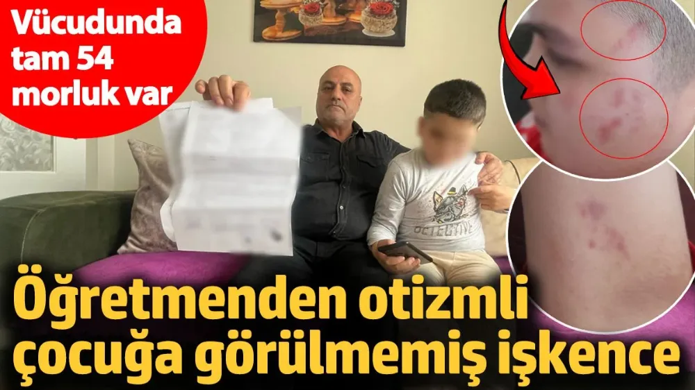 Öğretmenden otizmli çocuğa görülmemiş işkence