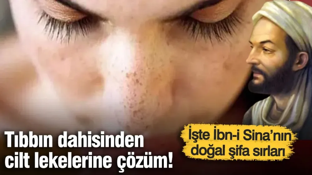 Tıbbın dahisinden cilt lekelerine çözüm