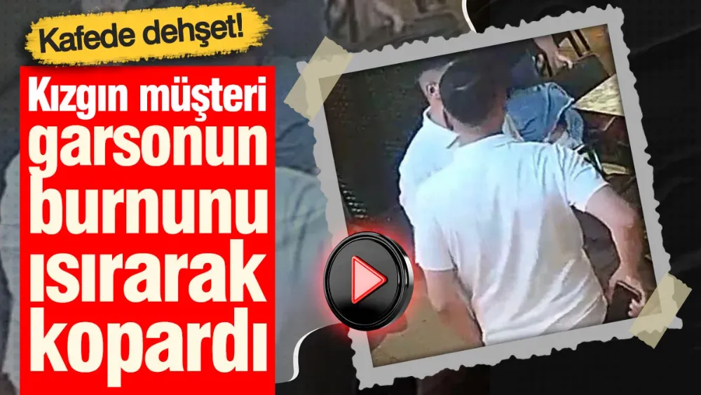 Kızgın müşteri garsonun burnunu ısırarak kopardı